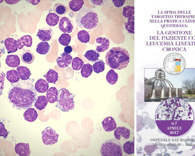 Corso “La sfida delle Targeted Therapies nella pratica clinica quotidiana: la gestione del paziente con leucemia linfatica cronica”
