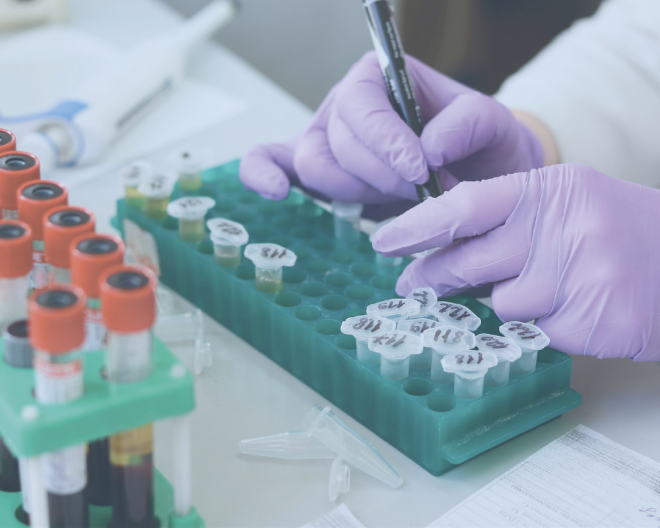 Bandi Fondazione Cariplo 2019: importanti finanziamenti per 4 ricercatori UniSR