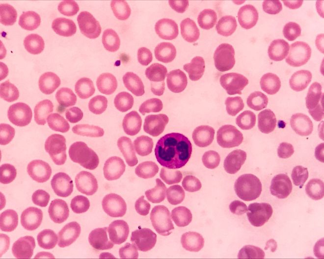 Donare il sangue: basti tu per fare la differenza