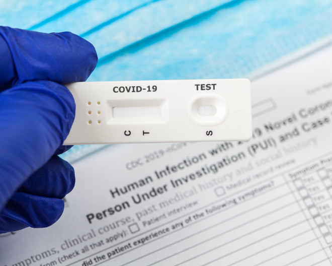 Test diagnostici rapidi contro Covid-19: UniSR partner del progetto CORONADX